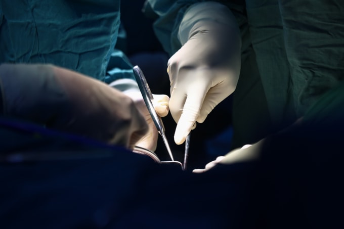 Bác sĩ phẫu thuật cho bệnh nhân. Ảnh: Quỳnh Trần