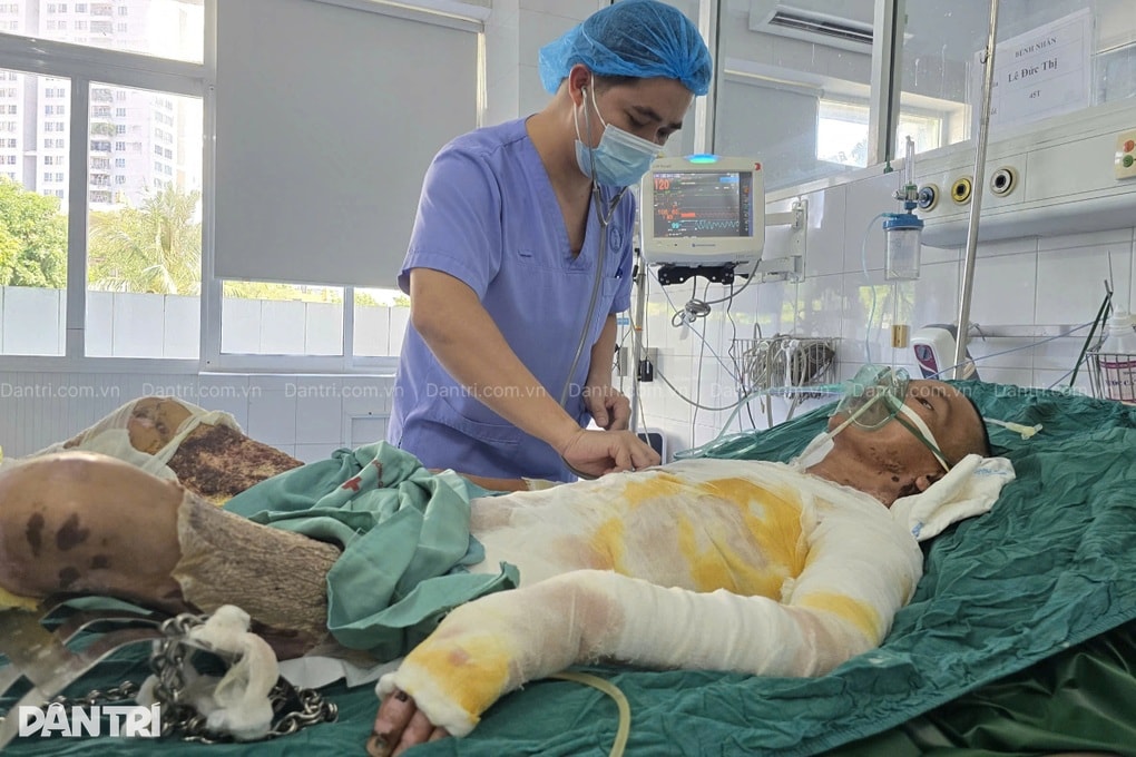 Ngã vào chảo mỡ bò đang sôi, người bố 2 con bỏng 75% cơ thể - 1 Ngã vào chảo mỡ bò đang sôi, người bố 2 con bỏng 75% cơ thể - 1