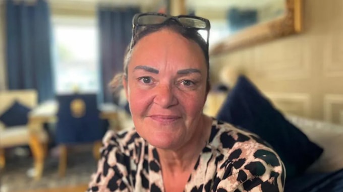 Bà Kellie, một nhân y tế, mất 4 chiếc răng sau khi làm liệu trình trắng răng từ năm 2015. Ảnh: BBC