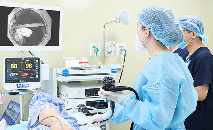 Bác sĩ Ngọc đang nội soi lấy dị vật cho ông Thành. Ảnh: Bệnh viện Đa khoa Tâm Anh