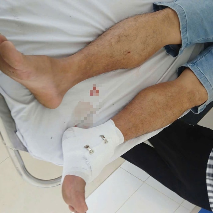 Vụ cá sấu sổng chuồng cắn thầy giáo ở Tây Ninh: Bất ngờ lời khai của người nuôi - Ảnh 2.