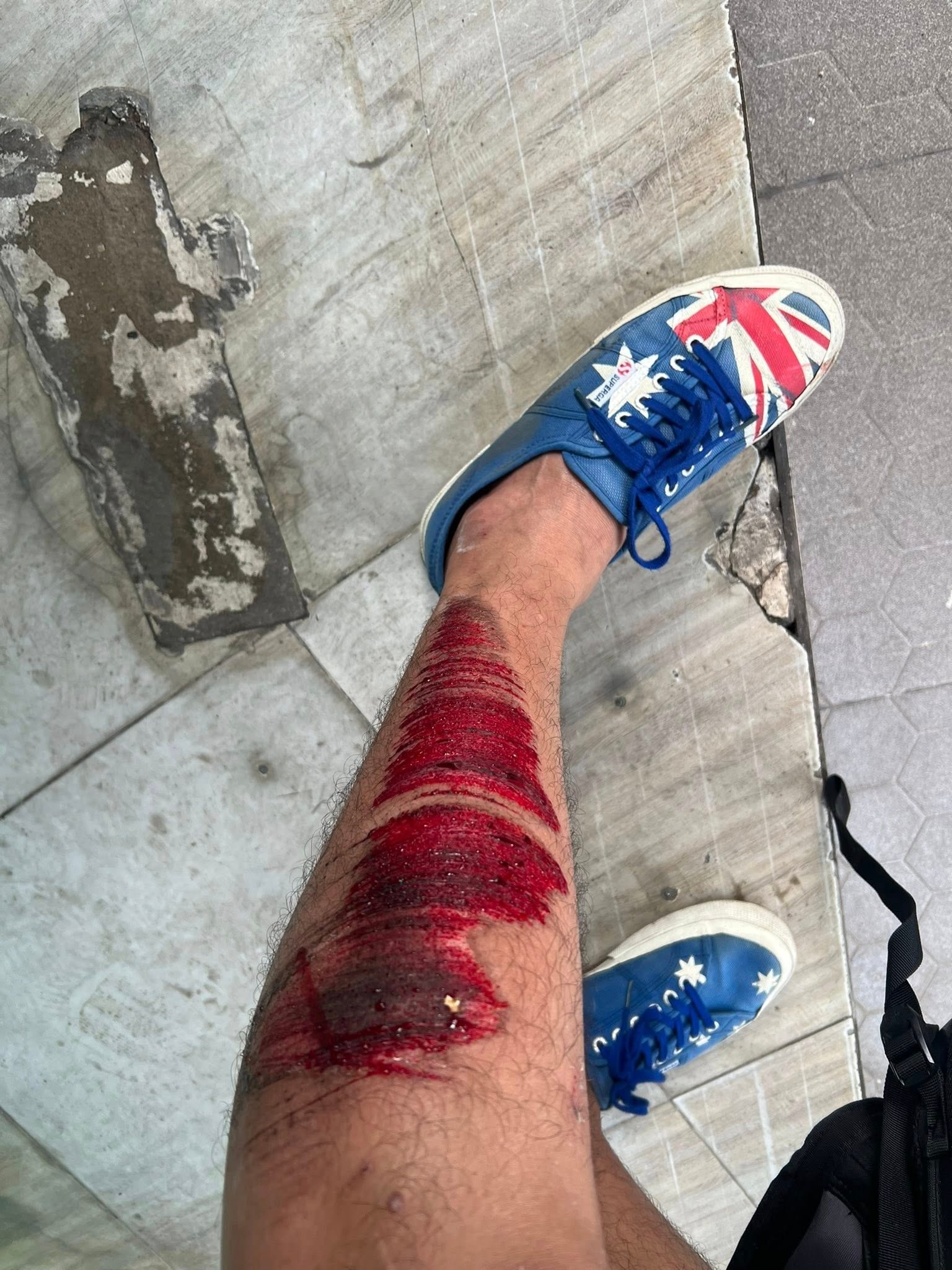 quách ngọc tuyên ảnh 2 quach ngoc tuyen anh 2