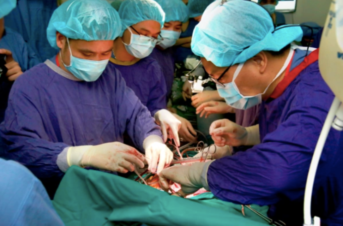 Các bác sĩ Bệnh viện Việt Đức thực hiện một ca ghép tạng. Ảnh: Bệnh viện cung cấp