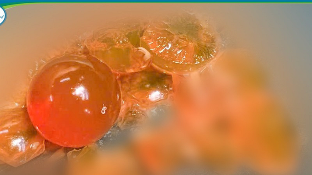 Bé trai 14 tháng tuổi chướng bụng, bố mẹ bất ngờ khi bác sĩ gắp ra thứ "đáng sợ" - Ảnh 1.