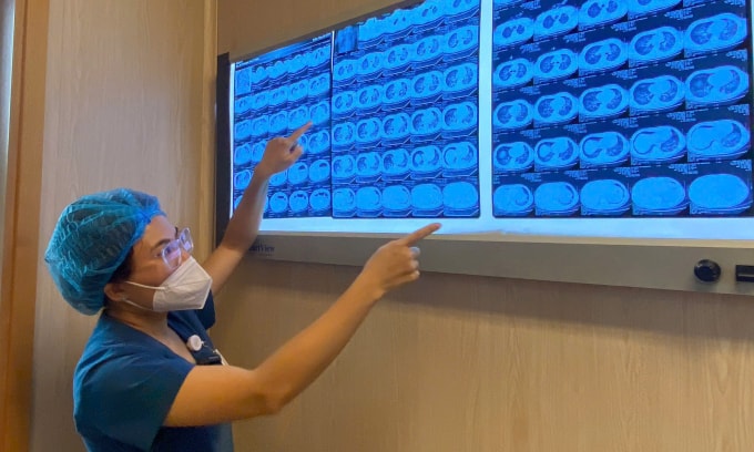 Bác sĩ kiểm tra phim chụp não cho bệnh nhân. Ảnh: Bệnh viện cung cấp