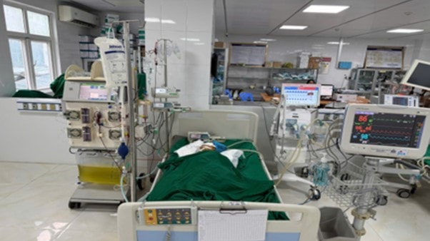 Bị ong vò vẽ đốt, bé gái 9 tuổi nguy kịch - Ảnh 1.