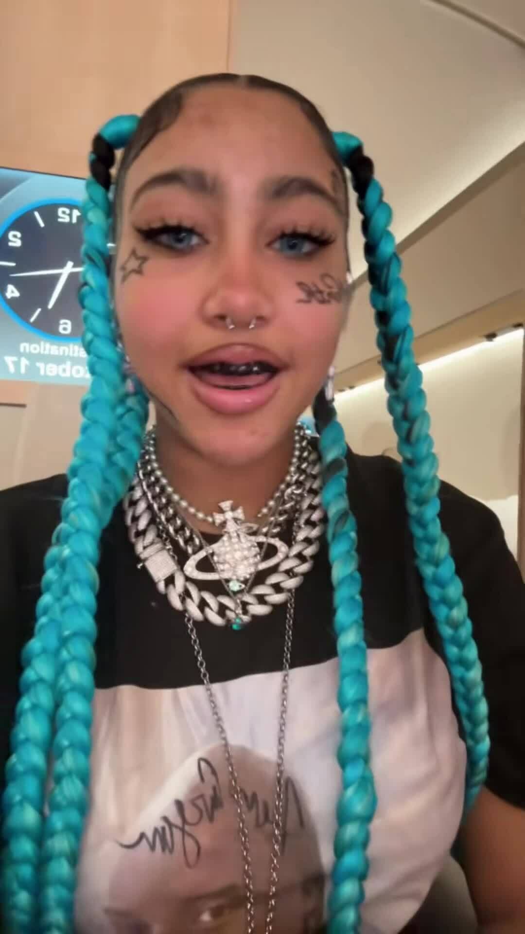 Nha sĩ cảnh báo mốt răng đen 'kiểu con gái Kim Kardashian'