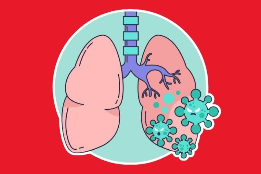 Viêm phổi là một tình trạng nhiễm trùng nghiêm trọng ở phổi