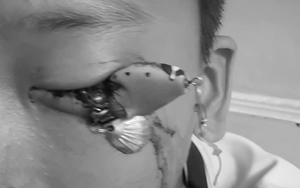 Người đàn ông liên tục đau bụng, bác sĩ sốc nặng khi phát hiện "bí mật" đáng sợ- Ảnh 3. Người đàn ông liên tục đau bụng, bác sĩ sốc nặng khi phát hiện "bí mật" đáng sợ- Ảnh 3.