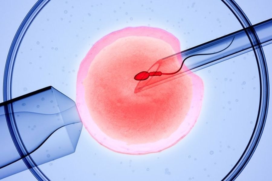 Thụ tinh ống nghiệm (IVF)
