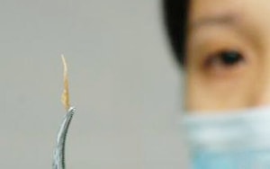 Ẩu đả với hàng xóm, người đàn ông bị chém đứt lìa 2 bàn tay được các bác sĩ nối thành công - Ảnh 3.