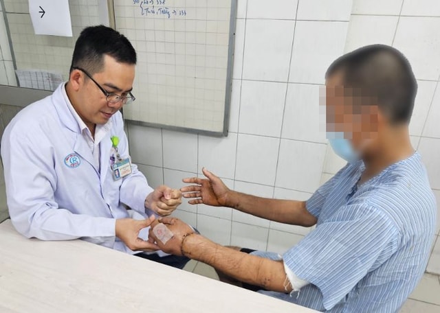 Ẩu đả với hàng xóm, người đàn ông bị chém đứt lìa 2 bàn tay được các bác sĩ nối thành công  - Ảnh 2.