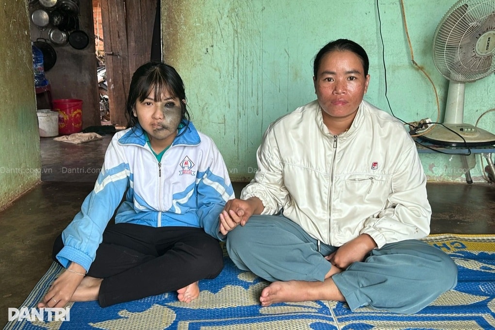 Nỗi đau ẩn phía sau lớp khẩu trang của nữ sinh mồ côi mẹ - 2 Nỗi đau ẩn phía sau lớp khẩu trang của nữ sinh mồ côi mẹ - 2