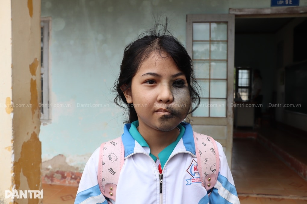 Nỗi đau ẩn phía sau lớp khẩu trang của nữ sinh mồ côi mẹ - 1 Nỗi đau ẩn phía sau lớp khẩu trang của nữ sinh mồ côi mẹ - 1