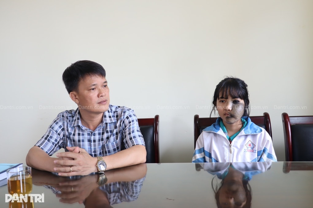 Nỗi đau ẩn phía sau lớp khẩu trang của nữ sinh mồ côi mẹ - 4 Nỗi đau ẩn phía sau lớp khẩu trang của nữ sinh mồ côi mẹ - 4