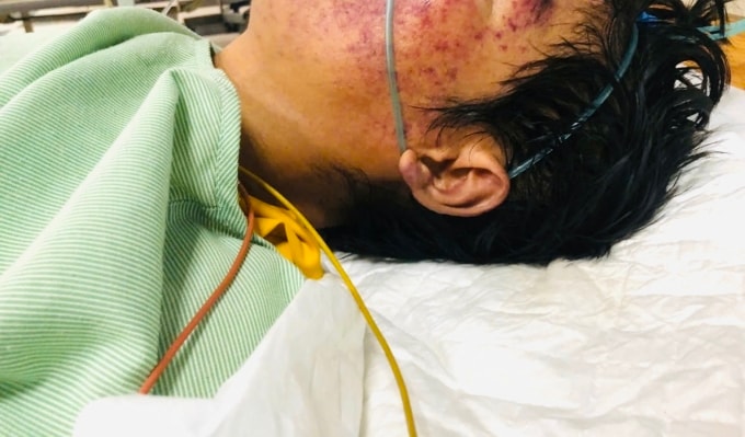 Bệnh nhân điều trị tại viện. Ảnh: Bệnh viện cung cấp