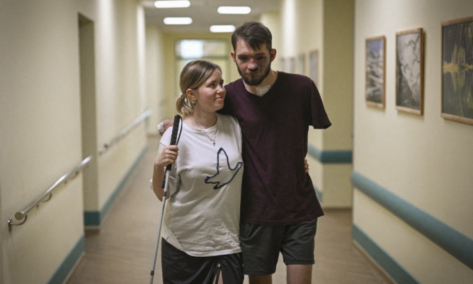 Quân nhân Ukraine bị mất một tay được điều trị ở bệnh viện tại Kiev hôm 31/8. Ảnh: AFP