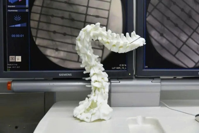 Mô hình in 3D về cột sống của Luo. Ảnh: QQ