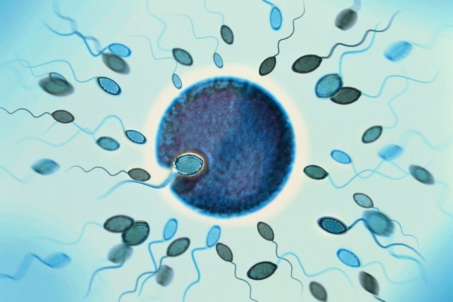 Chất lượng tinh trùng là yếu tố quan trọng ảnh hưởng đến kết quả IVF (Pinterest)