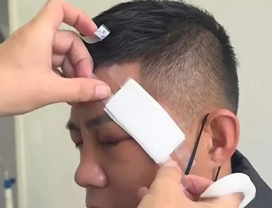 Do chấn thương ở vùng mắt quá nặng, Triệu Hồng Cương gần như phải giã từ sự nghiệp thi đấu ở PowerSlap