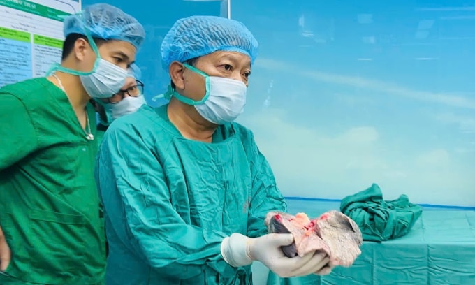 Các bác sĩ đưa phổi ghép cho bệnh nhân. Ảnh: Ngọc Khánh