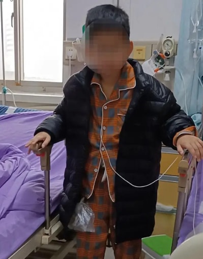 Sau phẫu thuật, Xiaoye phải sống bằng dinh dưỡng tĩnh mạch. Ảnh: Weibo