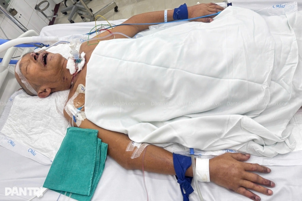 Vợ ung thư gục ngã khi chồng nguy kịch trong phòng hồi sức - 4 Vợ ung thư gục ngã khi chồng nguy kịch trong phòng hồi sức - 4