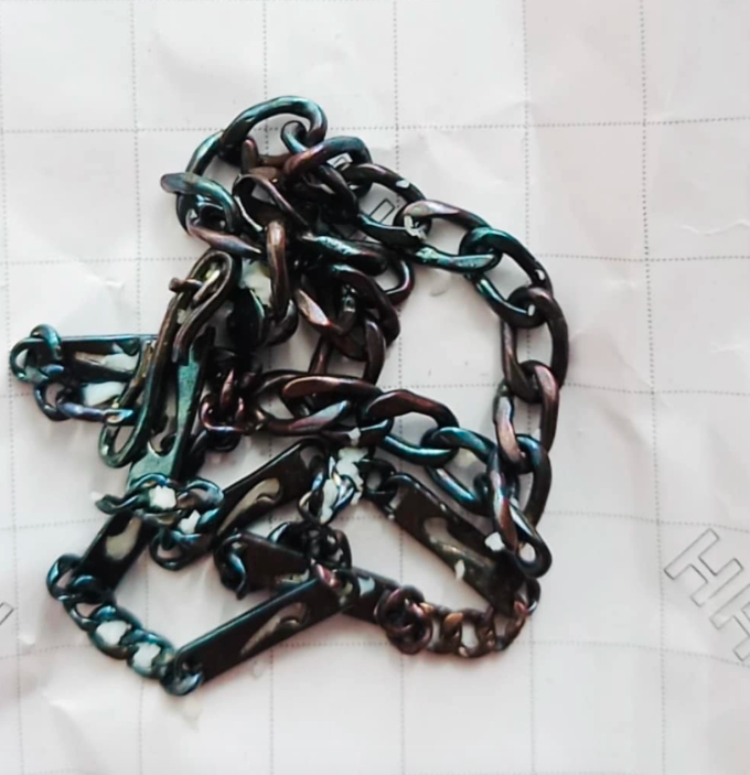 Dây bạc đổi màu sau khi được một bệnh nhân dùng đánh cảm. Ảnh: Nhân vật cung cấp