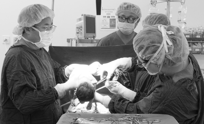 Các y bác sĩ mổ giúp em bé chào đời an toàn, sau đó xử trí phần u xơ tử cung. Ảnh: Bệnh viện cung cấp