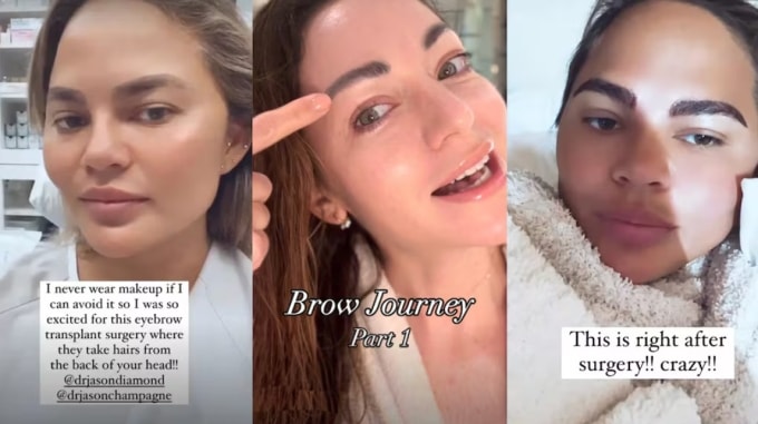 Sau dịch, ngày càng có nhiều phụ nữ đạt được cặp lông mày dày và rậm rạp qua phương pháp cấy lông mày. Ảnh: BoF Studio