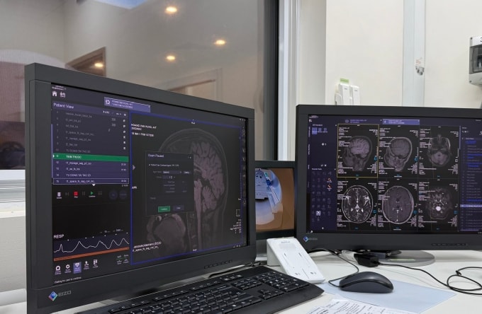 Chụp cộng hưởng từ với chuỗi xung đặc hiệu cho xơ cứng rải rác tại Bệnh viện Quân y 175. Ảnh: Bác sĩ cung cấp