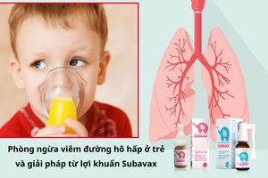 Ghi nhận 8.500 - 11.000 ca viêm đường hô hấp mỗi tháng trong quý cuối năm - Ảnh 2.