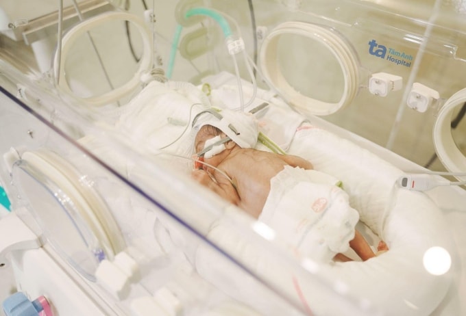Bé được nuôi dưỡng trong lồng ấp. Ảnh: Bệnh viện Đa khoa Tâm Anh