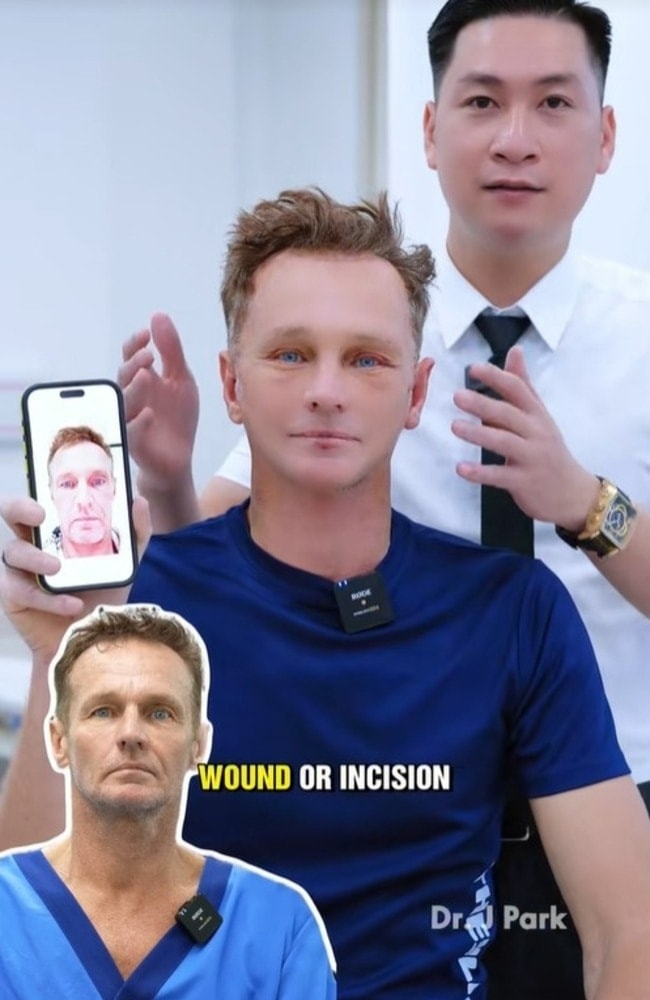 Jason trước và sau (đang cầm điện thoại) phẫu thuật. Ảnh: Daily Mail