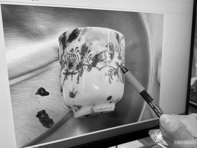 Chiếc cốc được lấy ra trong khoang chậu của người đàn ông ở thành phố Đài Trung, Đài Loan, Trung Quốc. Ảnh: