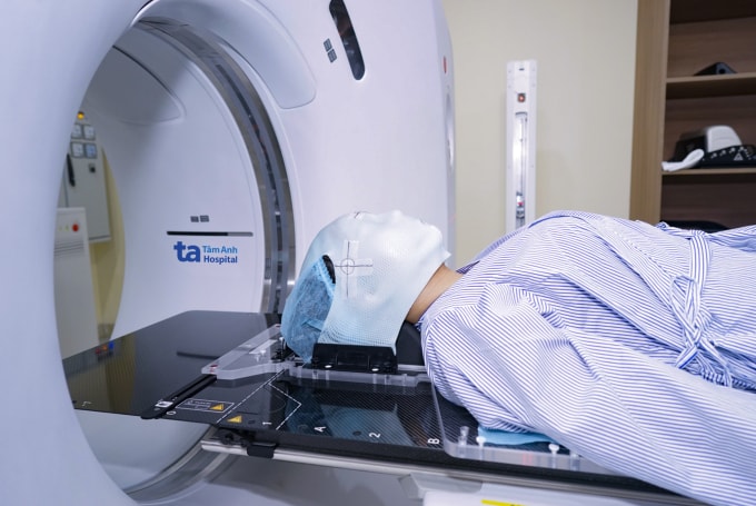 Mặt nạ giúp cố định vùng điều trị của người bệnh khi thực hiện CT mô phỏng trước xạ trị. Ảnh: Bệnh viện Đa khoa Tâm Anh