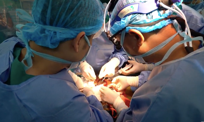 Các bác sĩ ghép gan cho bệnh nhi. Ảnh: Bệnh viện cung cấp