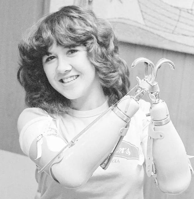 Mary Vincent phải sống với tay giả sau vụ án năm 1978. Ảnh: Film Daily