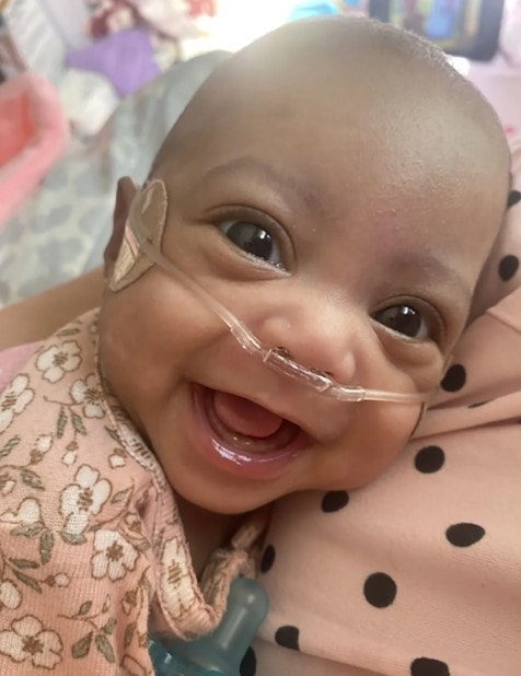 Bé Pinkney chỉ nặng 340 gram lúc mới chào đời. Ảnh: Miya Vidal