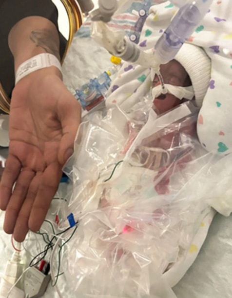 Bé Essence Pickney được chăm sóc trong NICU của Bệnh viện Nhi đồng Cleveland Clinic. Ảnh: Miya Vidal