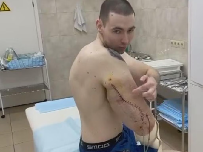 Tereshin khoe cánh tay sau ca phẫu thuật. Ảnh: Newsx