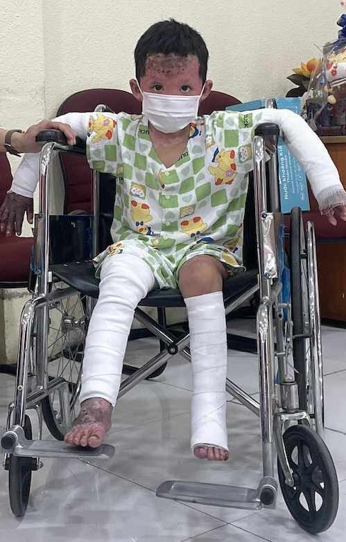 Bé trai tại Bệnh viện Nhi đồng 1, ngày 28/11. Ảnh: Thu Linh