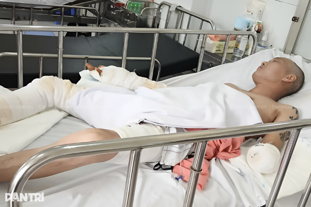 Vợ khóc ngất, đau thắt ruột gan khi chồng bị bỏng điện nguy kịch - 2 Vợ khóc ngất, đau thắt ruột gan khi chồng bị bỏng điện nguy kịch - 2