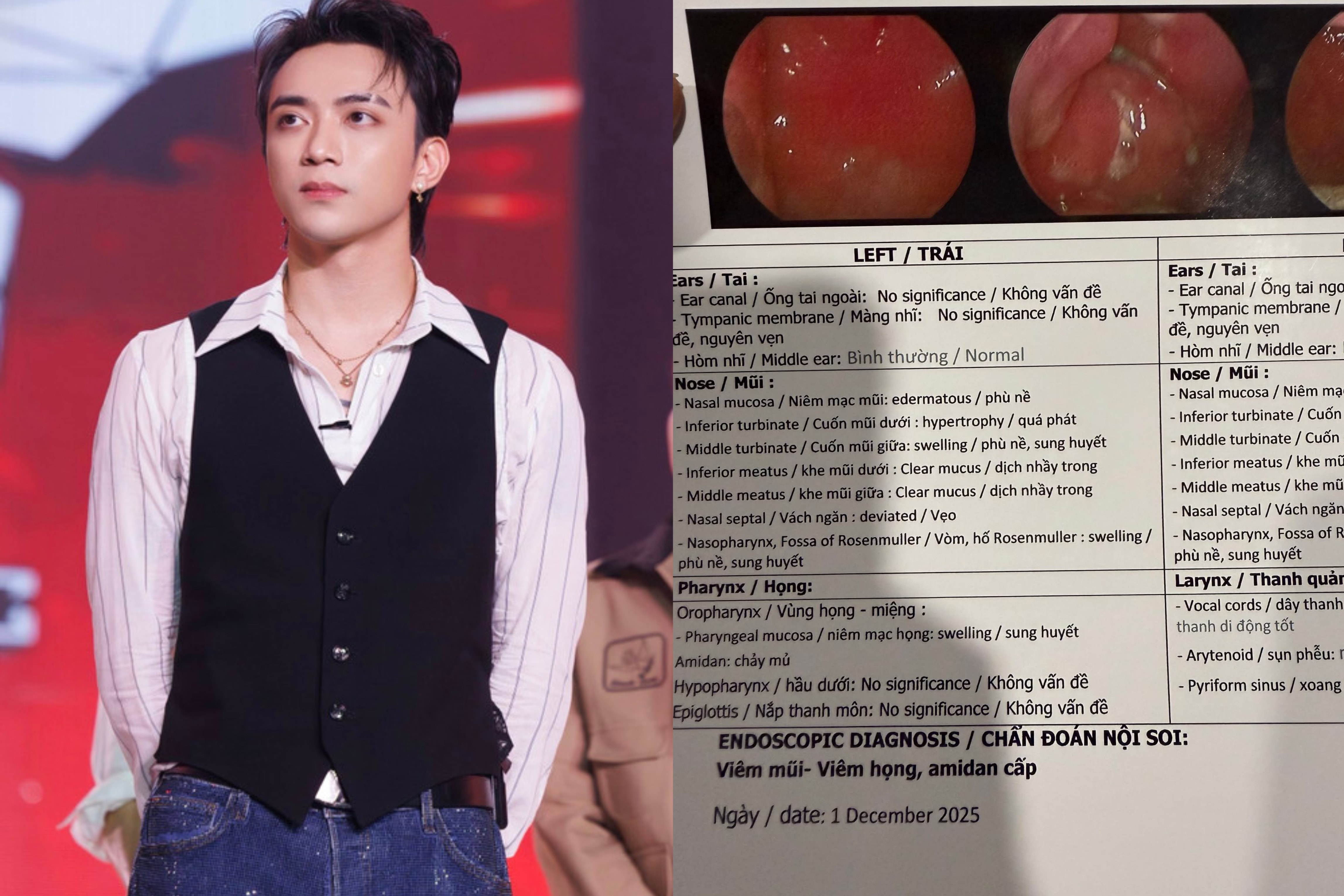 Soobin chia sẻ tình trạng sức khoẻ hậu concert.