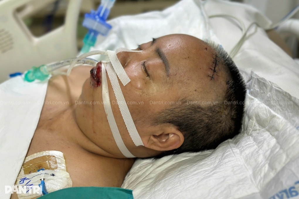 Mẹ nghèo đơn thân bán bánh nuôi con khuyết tật, nguy kịch vì xuất huyết não - 1