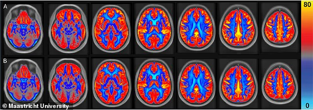 Bản đồ lưu lượng máu não trung bình sau khi nghiên cứu cho thấy (A) những người tham gia ăn đậu phộng và (B) những người tham gia trong thời gian kiểm soát