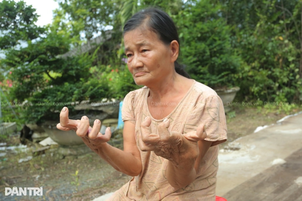 Nhà lá 30 năm bị cuốn sập, người phụ nữ tật nguyền sống nhờ hàng xóm - 3 Nhà lá 30 năm bị cuốn sập, người phụ nữ tật nguyền sống nhờ hàng xóm - 3