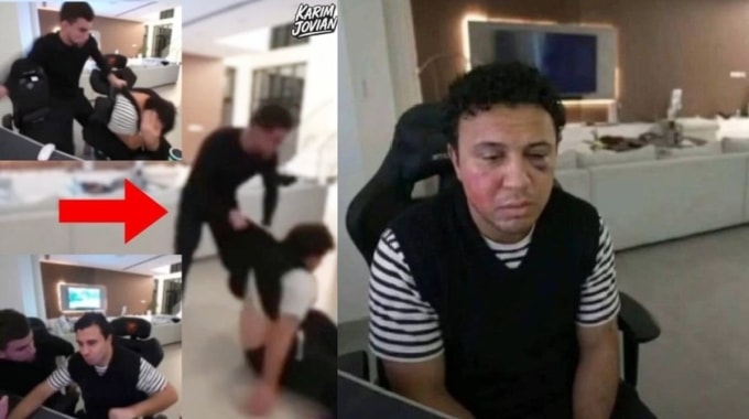 Gương mặt biến dạng của Mamedov sau khi nhận đòn từ Churchaev hôm 30/11. Ảnh: Dexerto