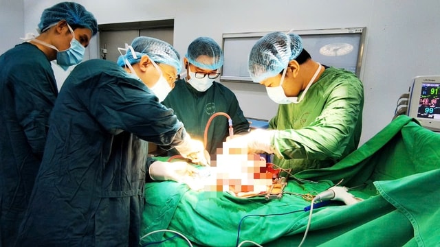 Khối u buồng trứng khổng lồ chiếm gần trọn bụng dưới của bệnh nhân 20 tuổi- Ảnh 2.