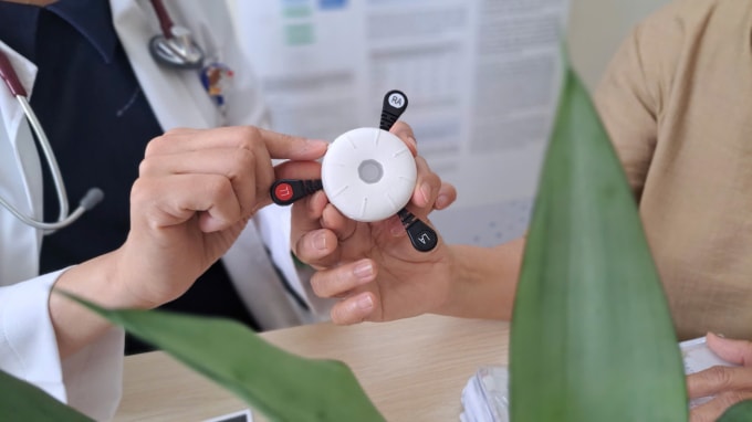 Thiết bị đeo thông minh tích hợp trí tuệ nhân tạo để tầm soát rối loạn nhịp tim do Bệnh viện Nguyễn Trãi phát triển. Ảnh: Bệnh viện cung cấp